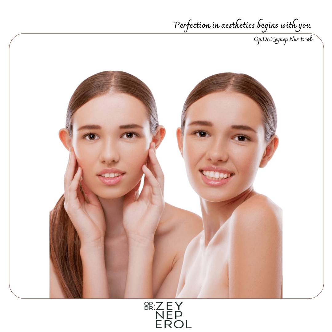 Chirurgie Esthétique des Oreilles Décollées